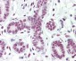 CTBP1 / CTBP Antibody (aa388-437)